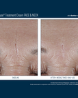 Skinbetter Interfuse Face and Neck