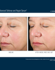 Skinbetter Alto Advanced Defense and Repair Serum