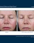 Skinbetter Alto Advanced Defense and Repair Serum