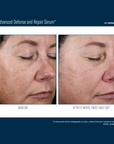 Skinbetter Alto Advanced Defense and Repair Serum