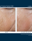 Skinbetter Interfuse Face and Neck