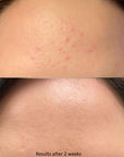 SavvyDerm Prep Pads 1.0