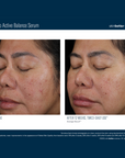 Skinbetter Mystro Active Balance Serum
