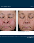 Skinbetter Mystro Active Balance Serum