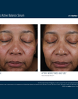 Skinbetter Mystro Active Balance Serum
