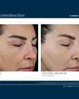 Skinbetter Mystro Active Balance Serum