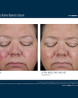 Skinbetter Mystro Active Balance Serum