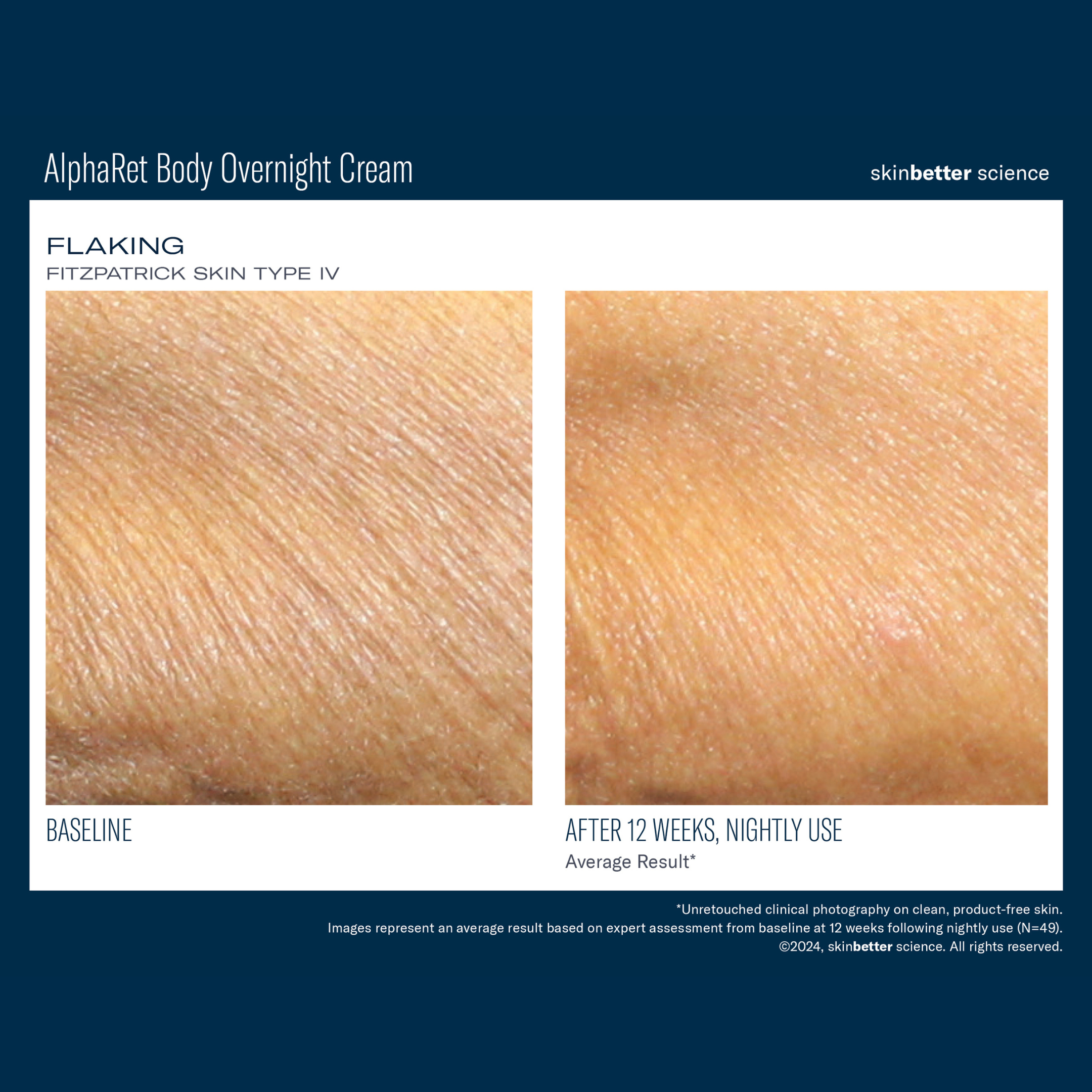 Skinbetter AlphaRet Body