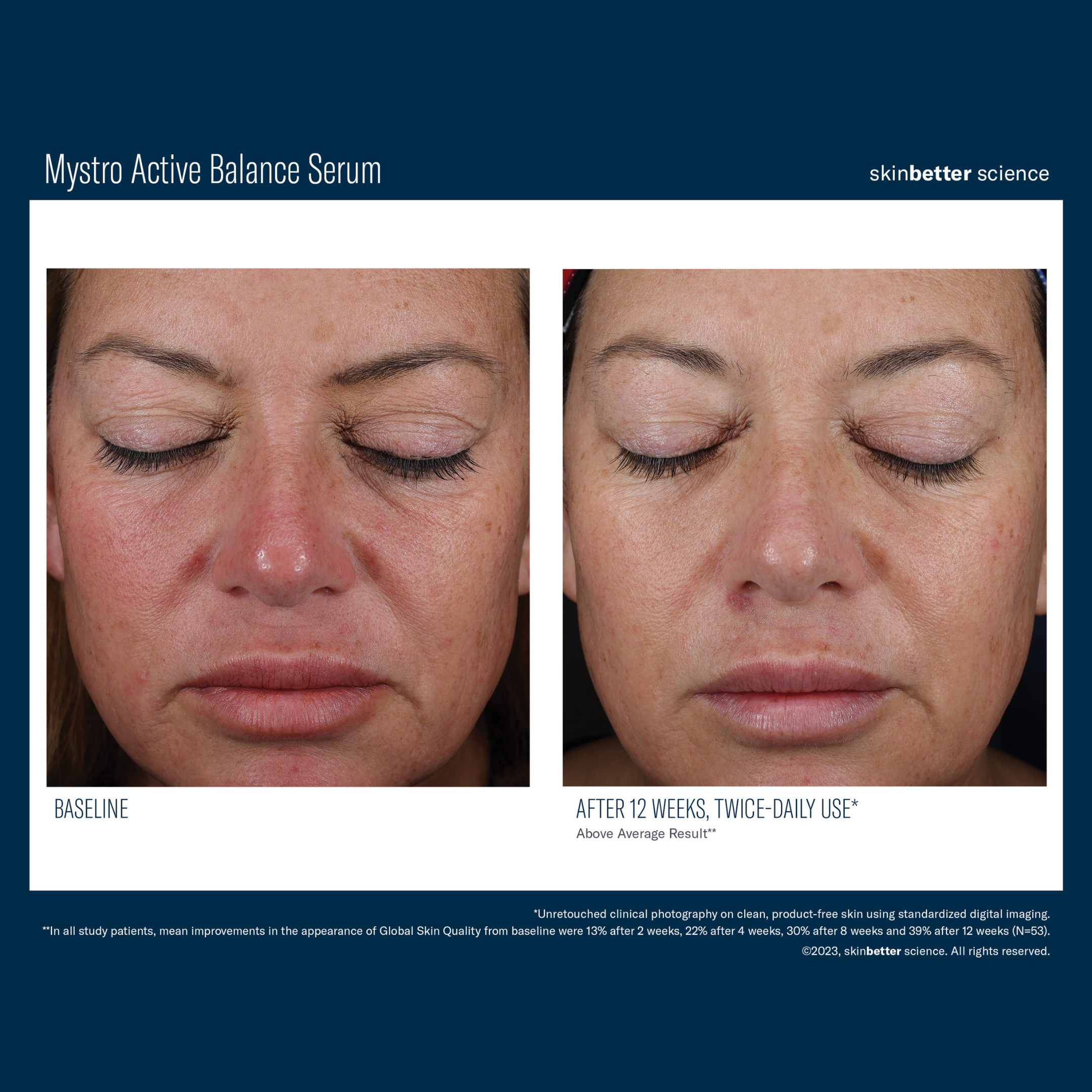 Skinbetter Mystro Active Balance Serum