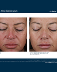 Skinbetter Mystro Active Balance Serum