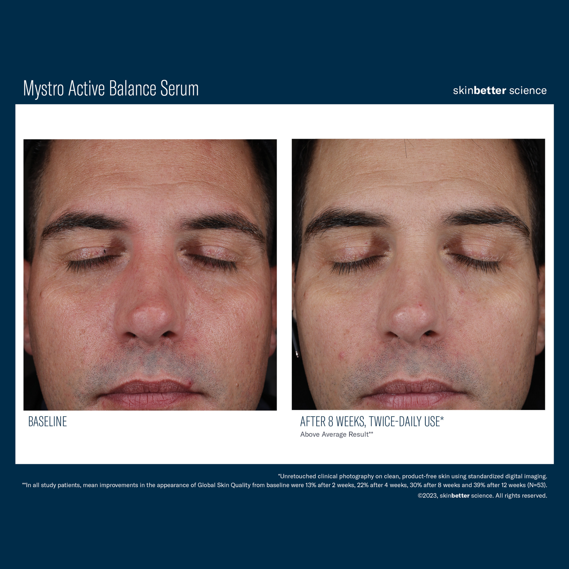 Skinbetter Mystro Active Balance Serum