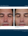 Skinbetter Mystro Active Balance Serum