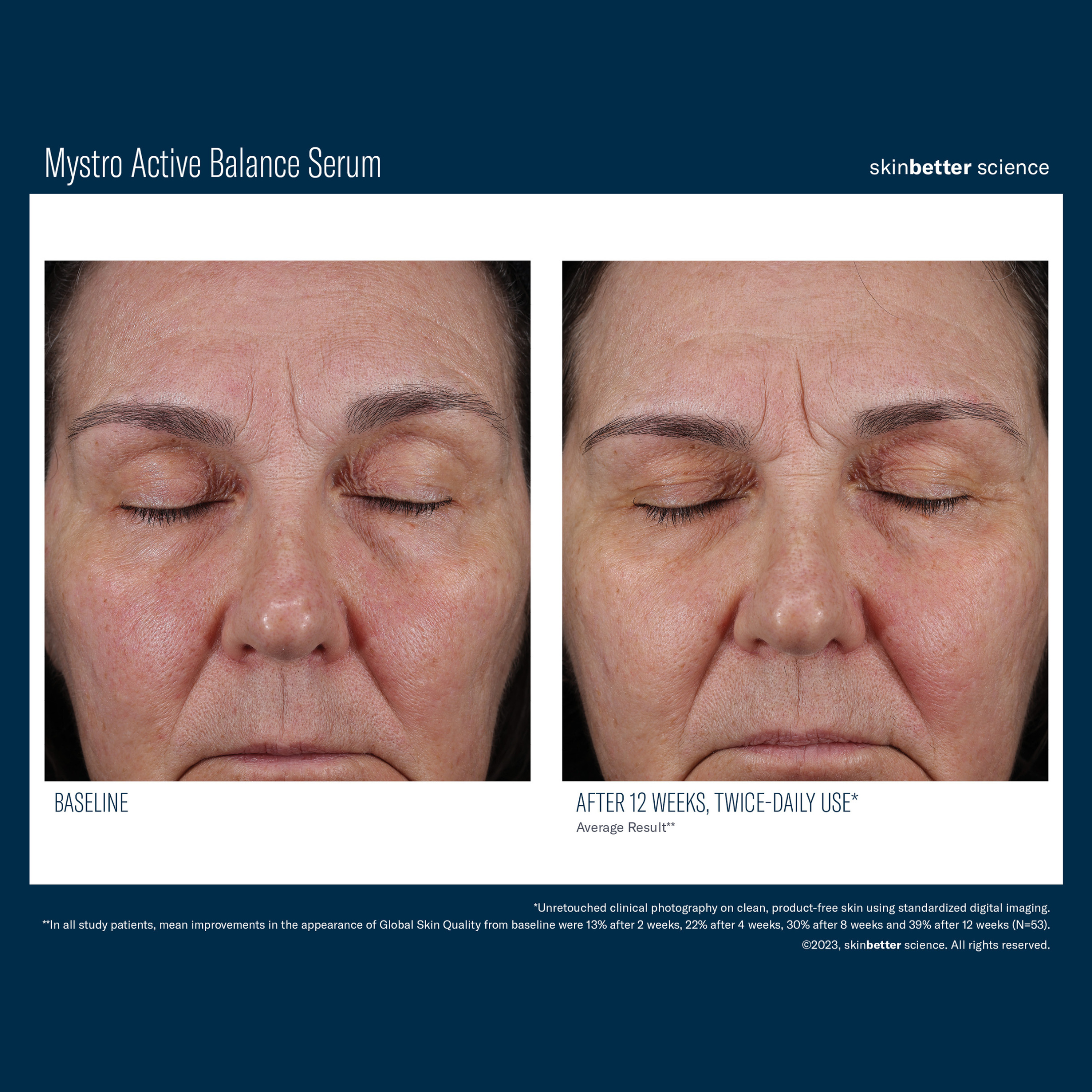 Skinbetter Mystro Active Balance Serum