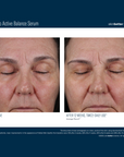 Skinbetter Mystro Active Balance Serum