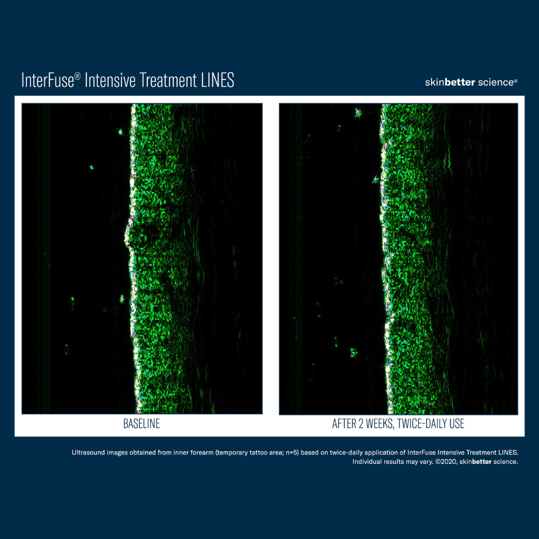 Skinbetter InterFuse Intensive Treatment LINES