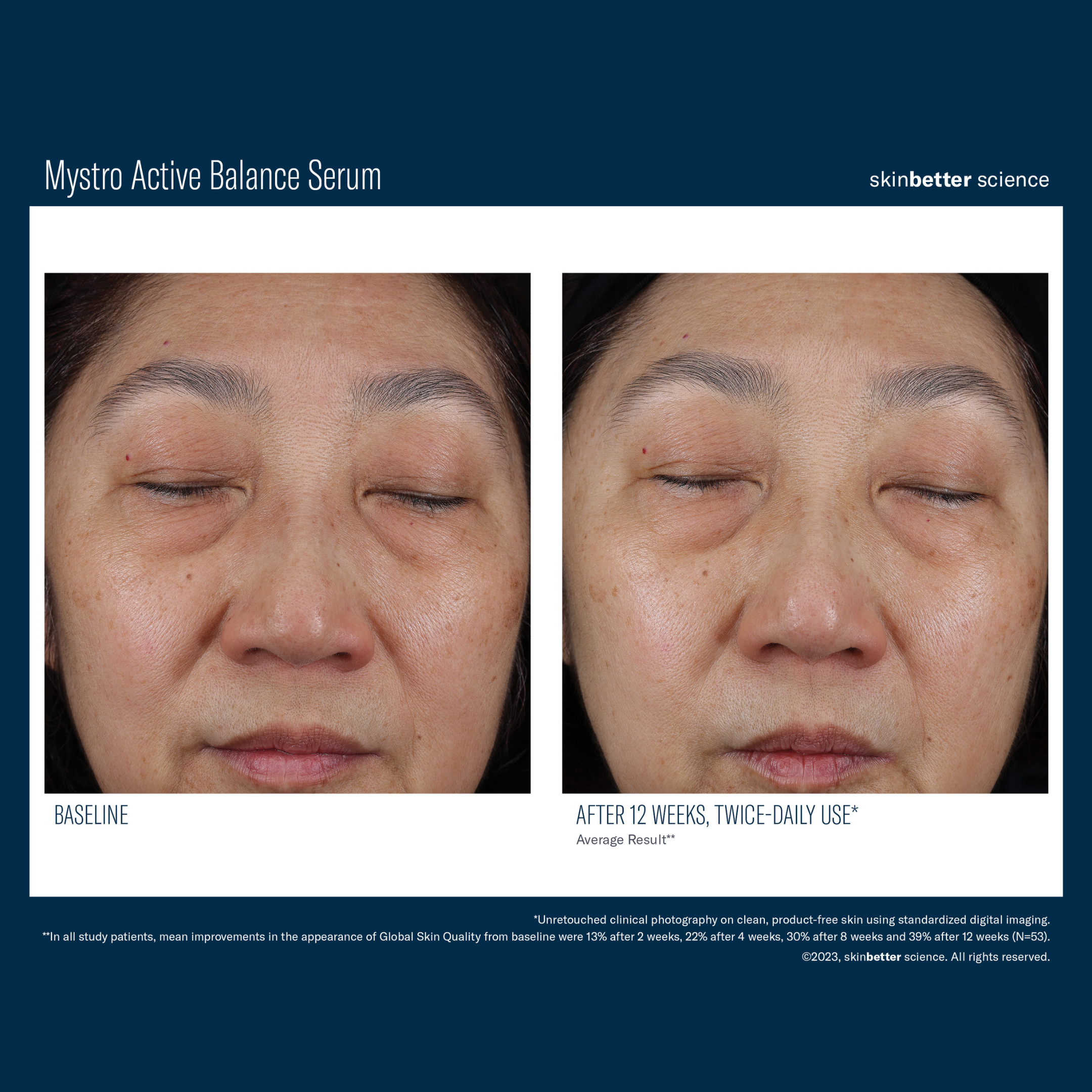 Skinbetter Mystro Active Balance Serum