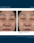 Skinbetter Mystro Active Balance Serum