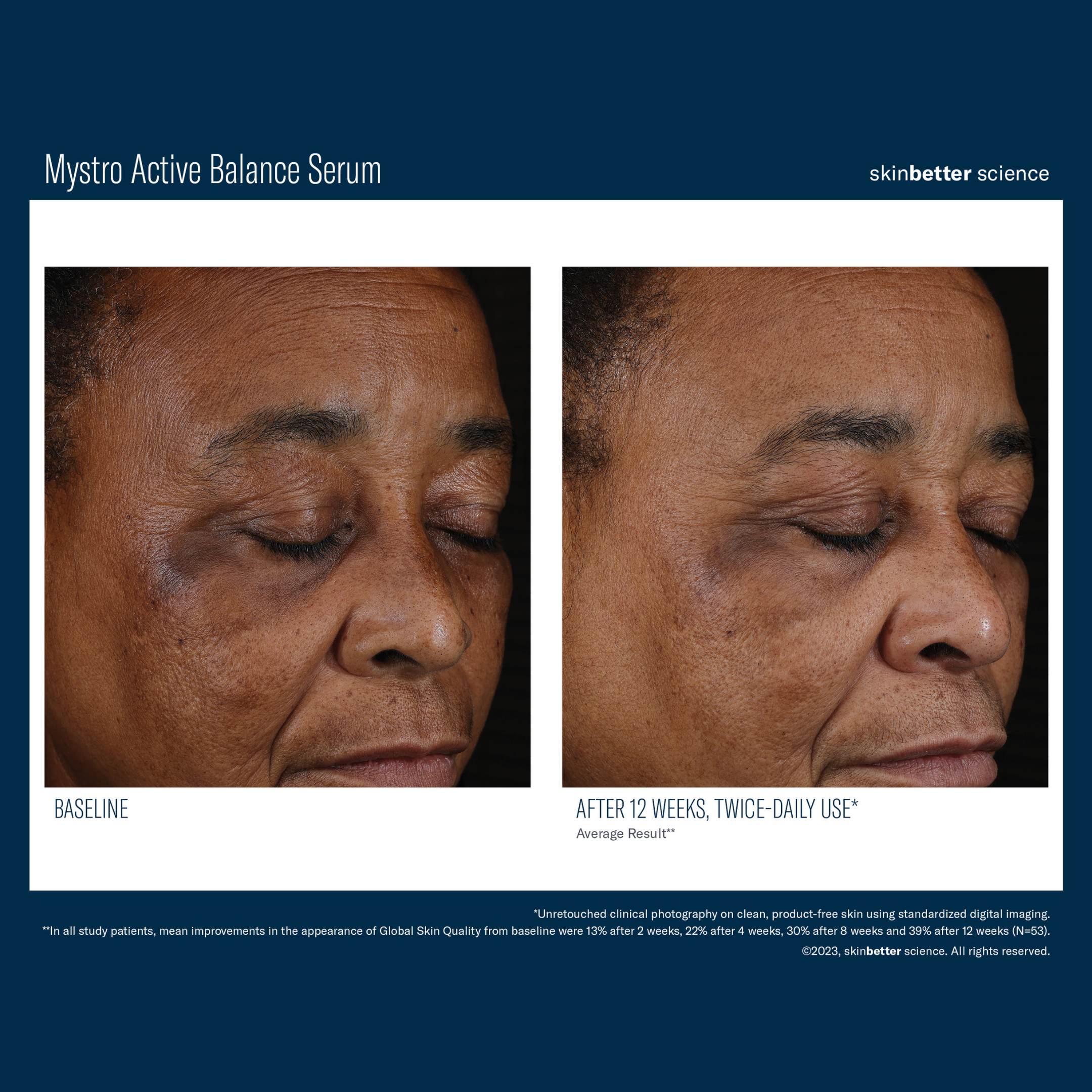 Skinbetter Mystro Active Balance Serum