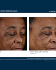 Skinbetter Mystro Active Balance Serum