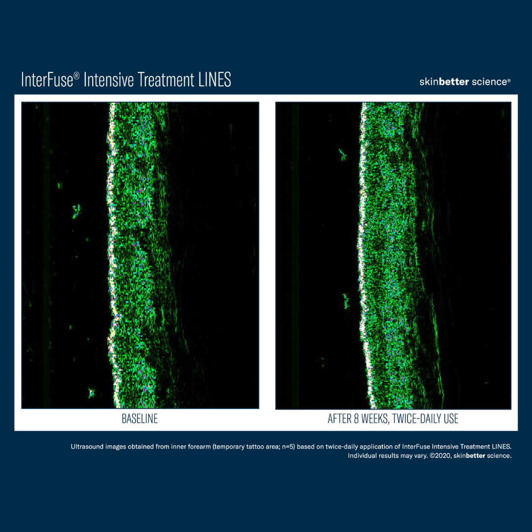 Skinbetter InterFuse Intensive Treatment LINES