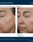 Before and after effects of Ampra Volumizing Macro HA Serum on skin plumpness and radiance.