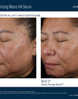 Before and after effects of Ampra Volumizing Macro HA Serum on a woman's face, showing improvements in lift and contours.