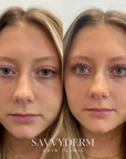 Obagi Nu-Cil Eyelash Enhancing Serum