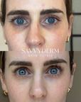 Hydrinity Eye Renew Complex