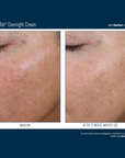 Skinbetter Alpharet Overnight Cream