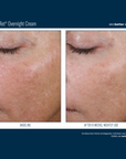 Skinbetter Alpharet Overnight Cream
