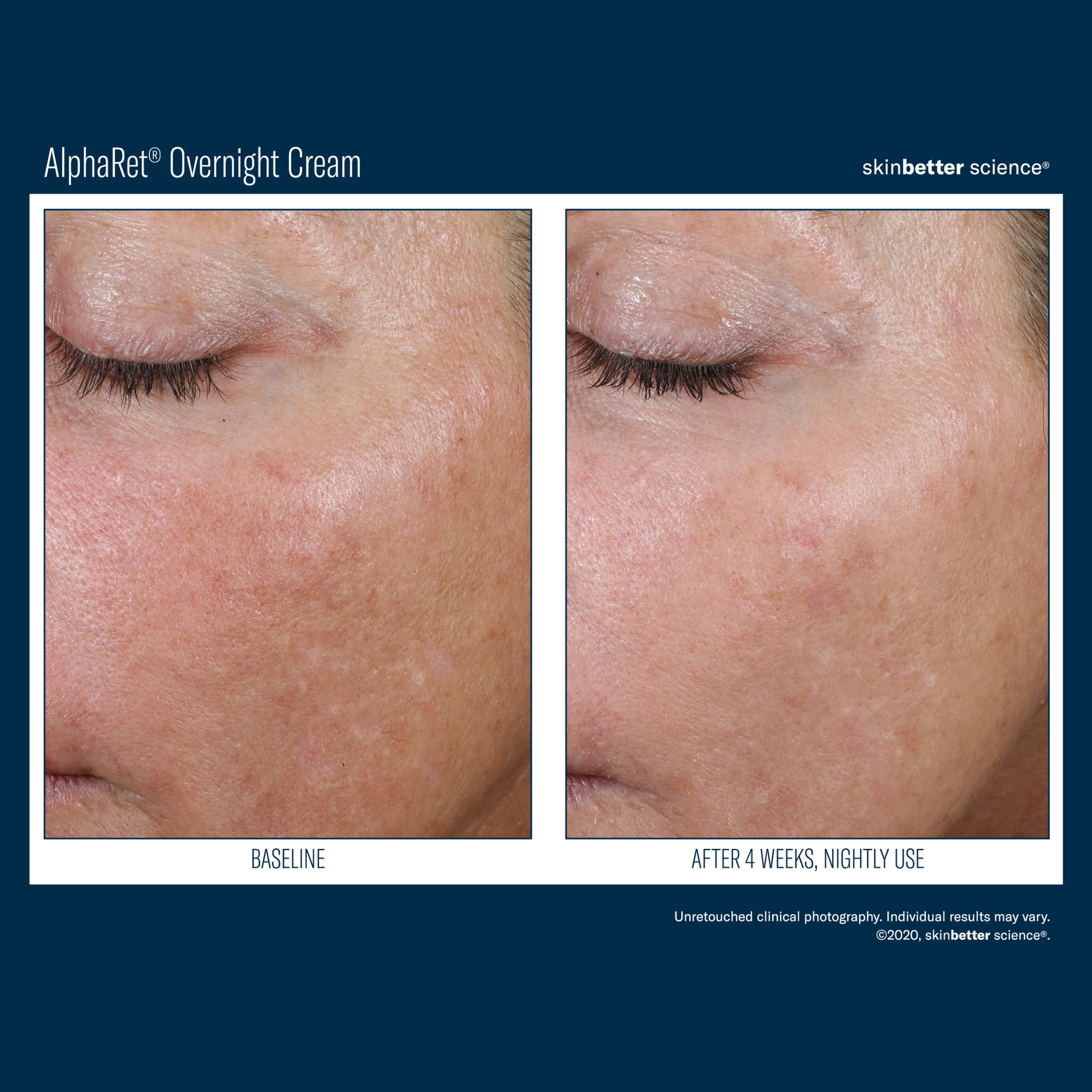 Skinbetter Alpharet Overnight Cream