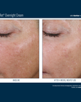 Skinbetter Alpharet Overnight Cream