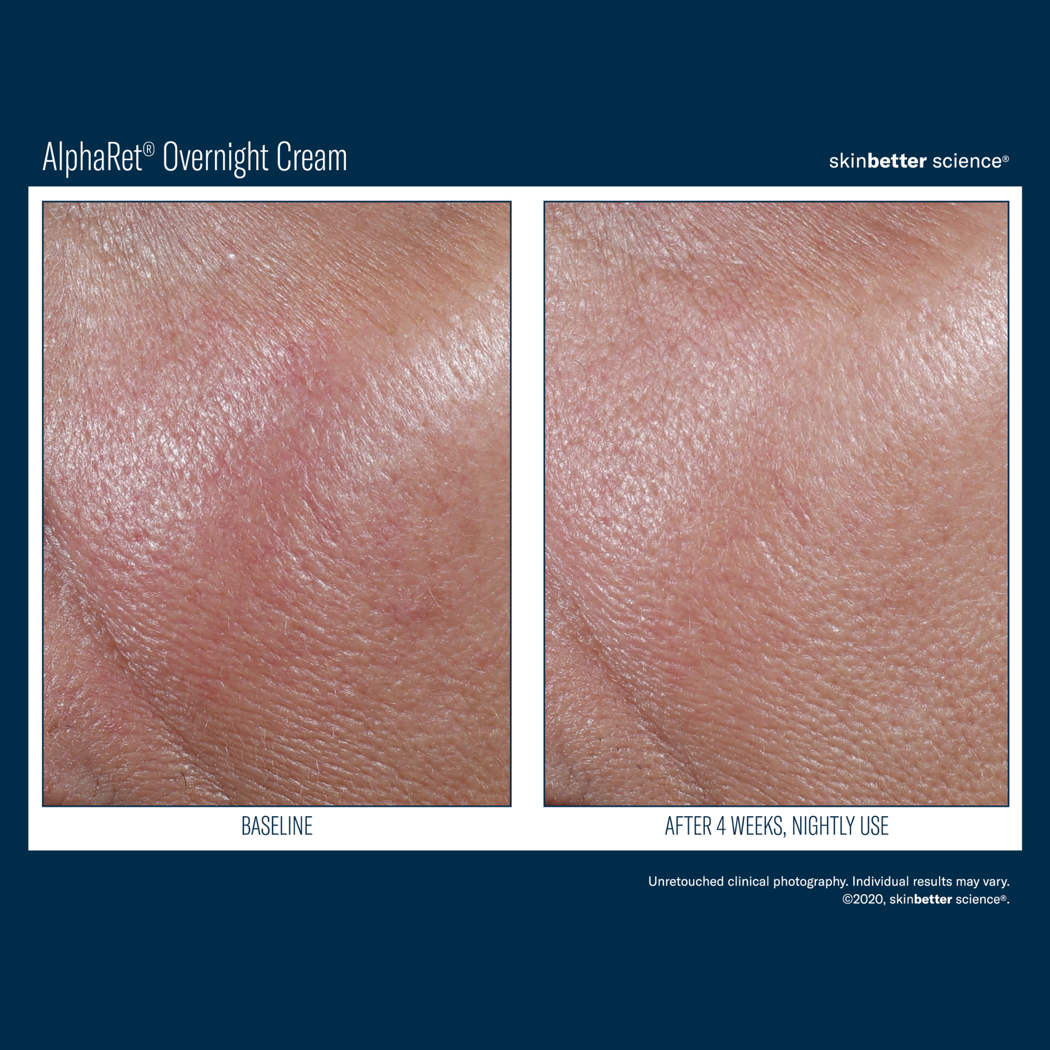 Skinbetter Alpharet Overnight Cream