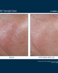 Skinbetter Alpharet Overnight Cream
