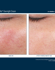Skinbetter Alpharet Overnight Cream