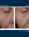 Skinbetter Alpharet Overnight Cream
