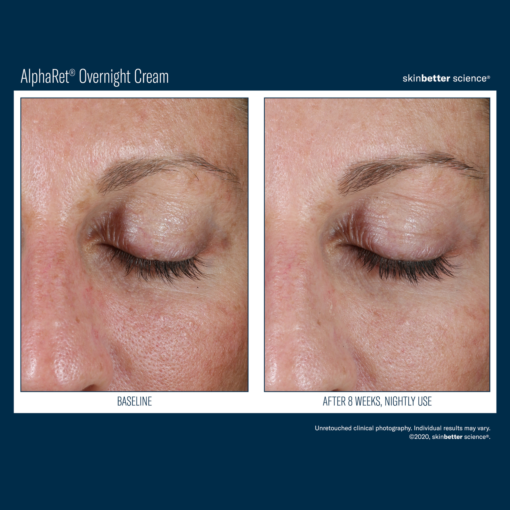 Skinbetter Alpharet Overnight Cream