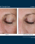 Skinbetter Alpharet Overnight Cream