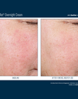 Skinbetter Alpharet Overnight Cream