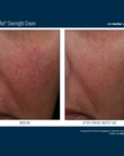 Skinbetter Alpharet Overnight Cream