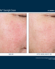 Skinbetter Alpharet Overnight Cream