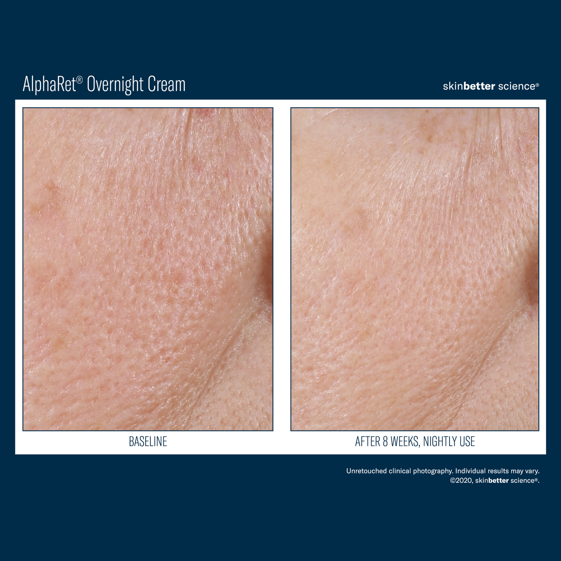 Skinbetter Alpharet Overnight Cream