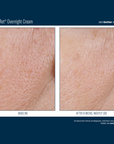 Skinbetter Alpharet Overnight Cream