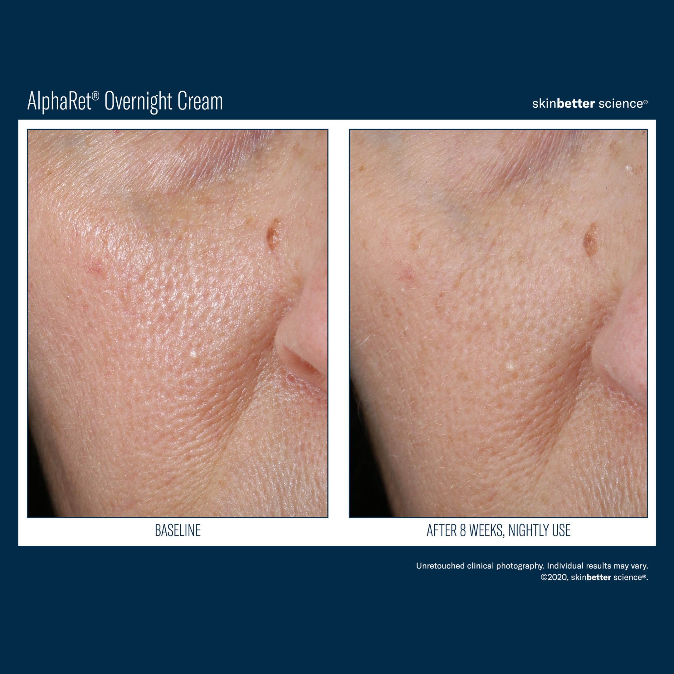 Skinbetter Alpharet Overnight Cream