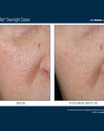 Skinbetter Alpharet Overnight Cream