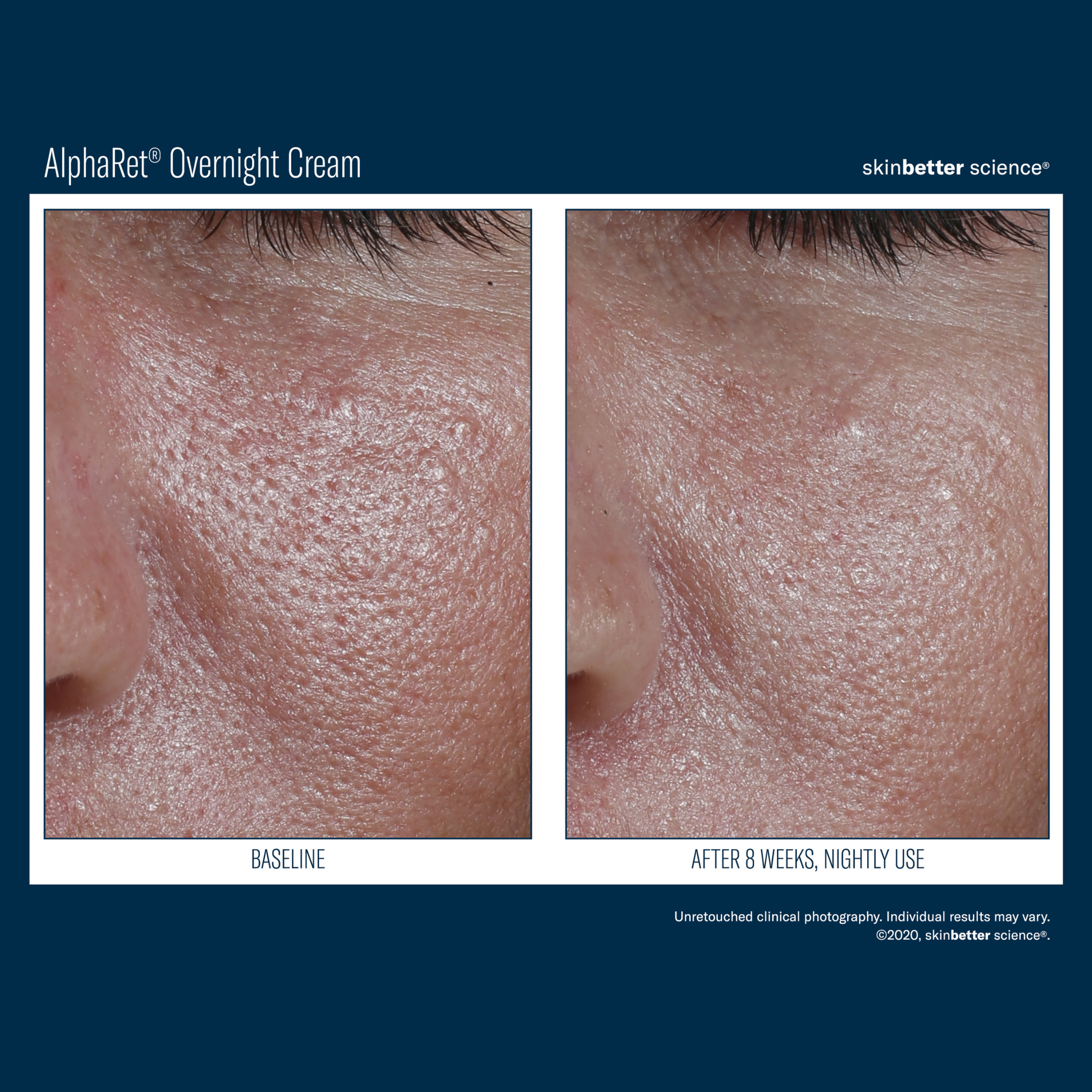 Skinbetter Alpharet Overnight Cream