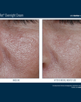 Skinbetter Alpharet Overnight Cream