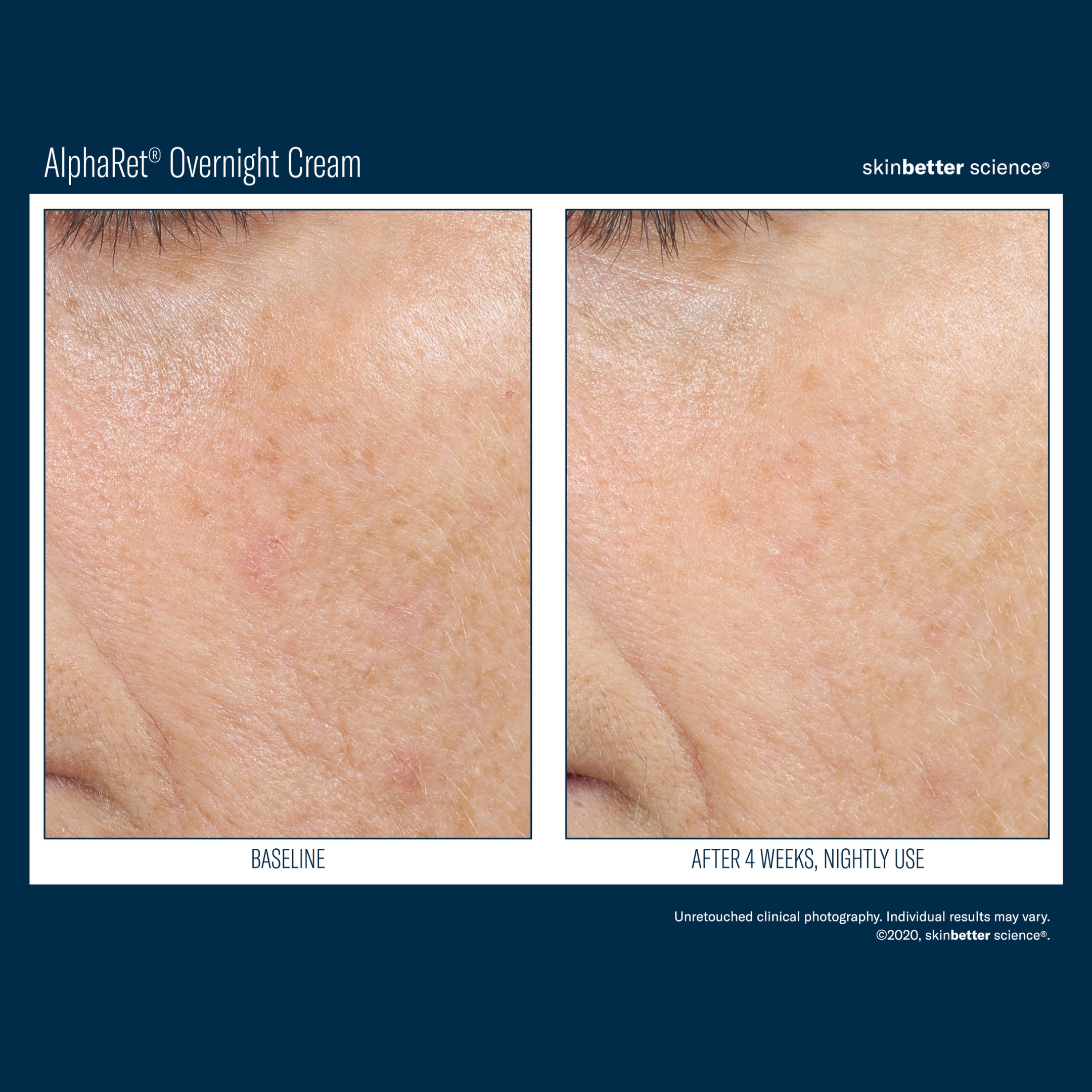 Skinbetter Alpharet Overnight Cream