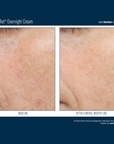 Skinbetter Alpharet Overnight Cream