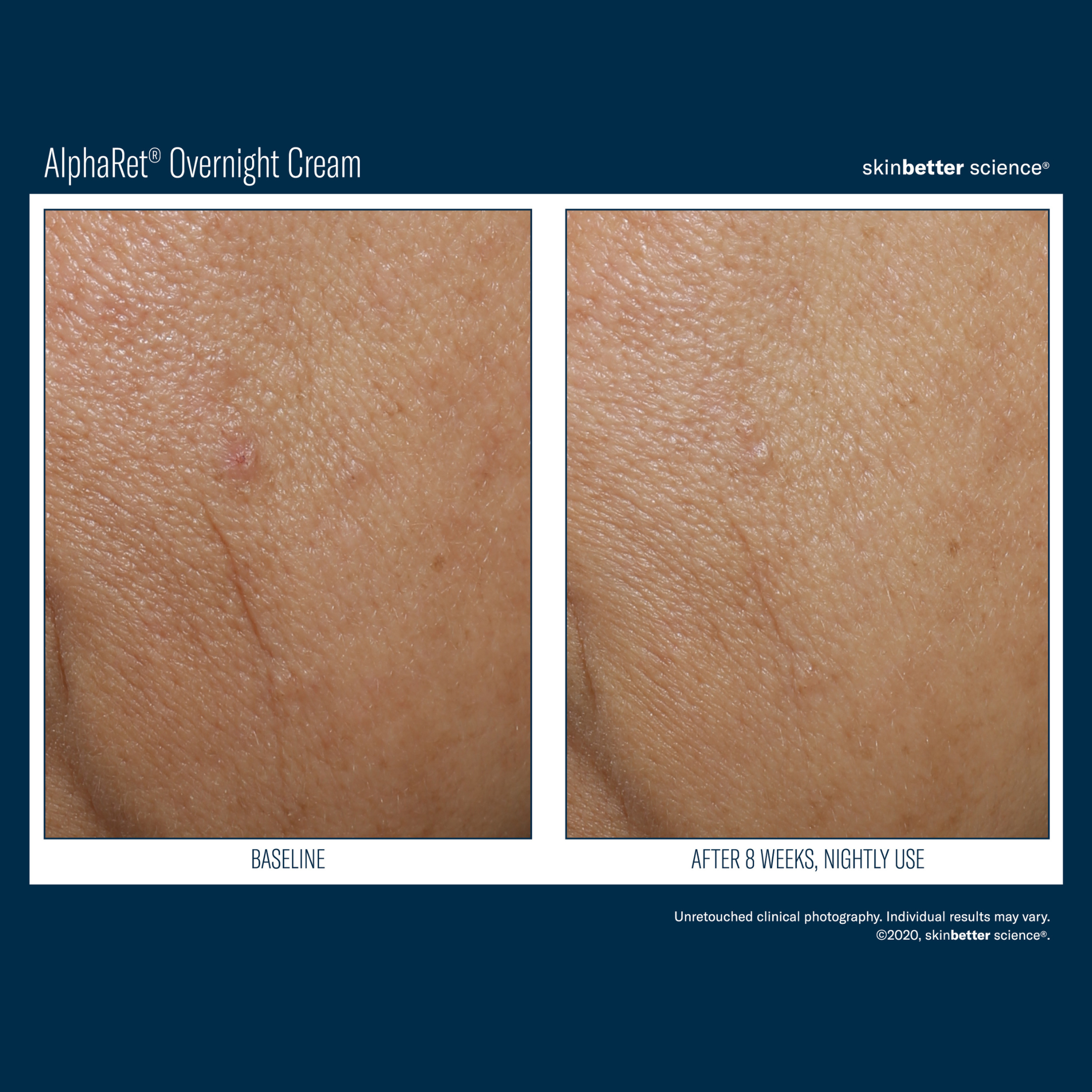 Skinbetter Alpharet Overnight Cream
